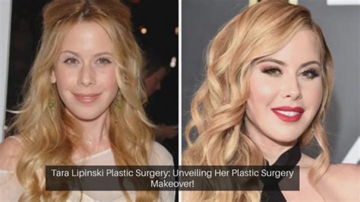 Alexis Bledel Plastic Surgery Before and After