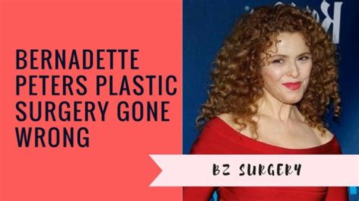 Bernadette Peters Plastic Surgery: Undergoing Procedures to Resist the Passage of Time?