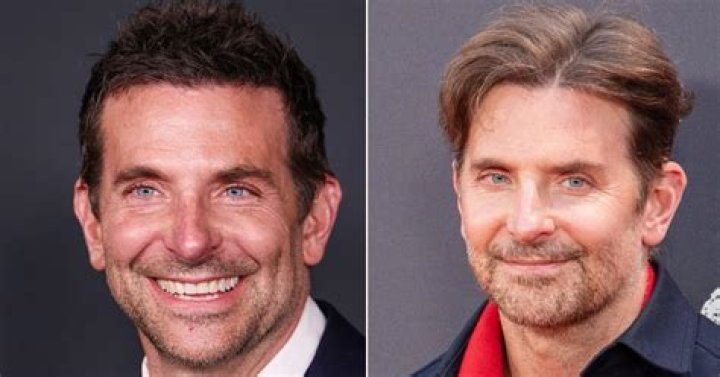 Bradley Cooper Plastic Surgery Before and After