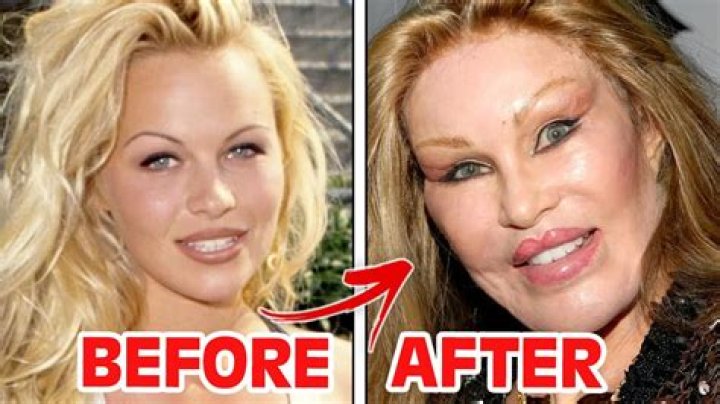 Bridget Moynahan Plastic Surgery Before and After