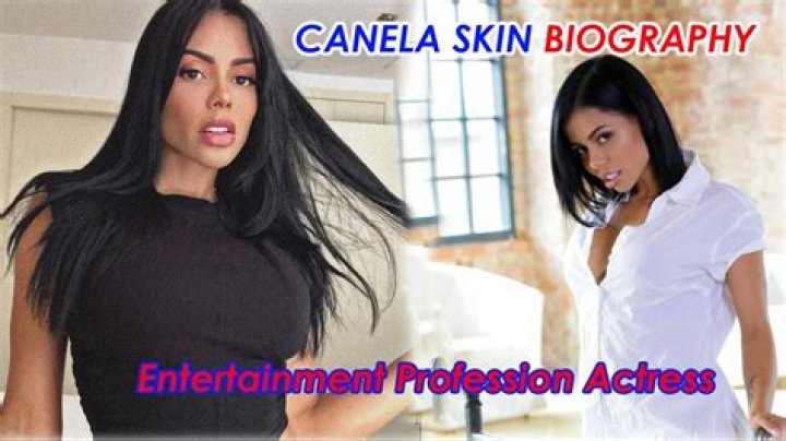 Canela Skin Biography, age, height, boyfriend, OnlyFans, leaks, videos, pictures, Twitter