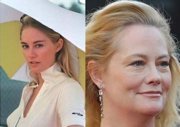 Cybill Shepherd Plastic Surgery Before and After Botox Injections