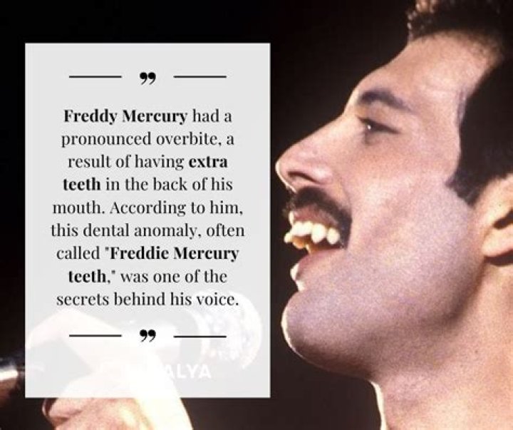 
How Much Money Does Freddie Mercury Make? Latest Income Salary

