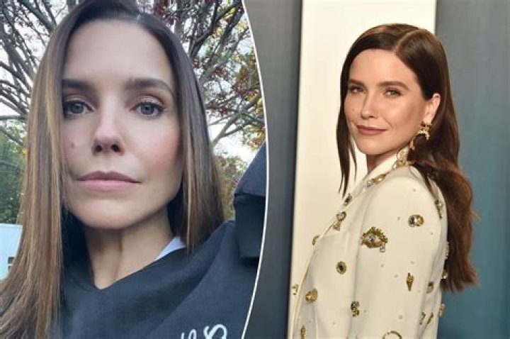 Sophia Bush Plastic Surgery Before and After