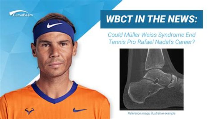 What is Rafael Nadal's illness? Mueller-Weiss syndrome explained